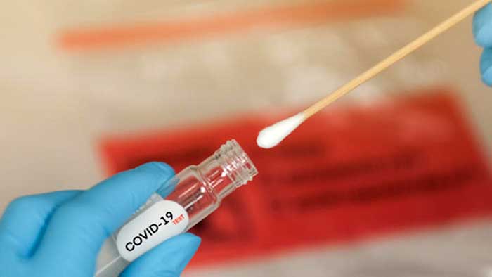 Covid antibodies detected up to 3 months after infection: Study