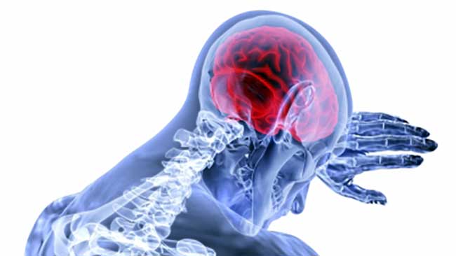 Diabetes, high BP raised brain stroke risk in Covid patients: Study