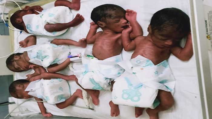 Woman gives birth to 5 children in UP district
