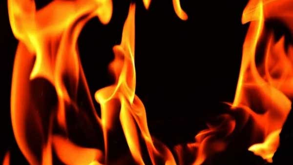 UP: Toddler set ablaze by her father succumbs
