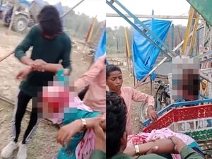 Girl's hair gets entangled in swing's rod in Uttar Pradesh; scalp ripped off